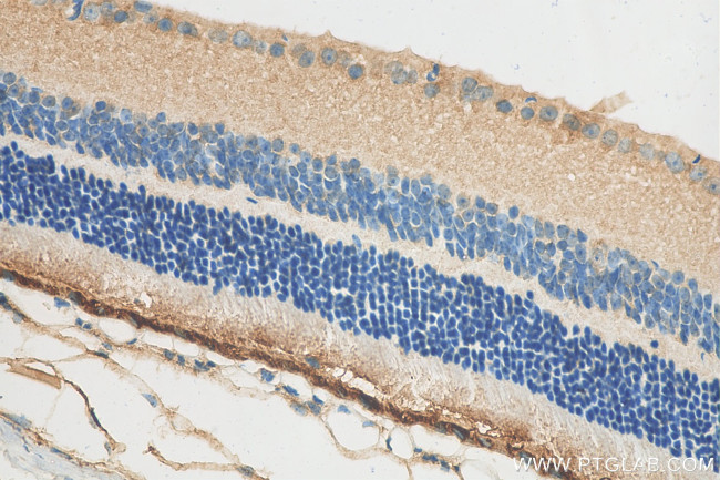 RPE65 Antibody in Immunohistochemistry (Paraffin) (IHC (P))