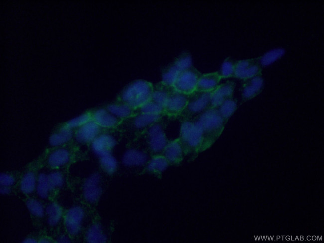 ELA2 Antibody in Immunocytochemistry (ICC/IF)