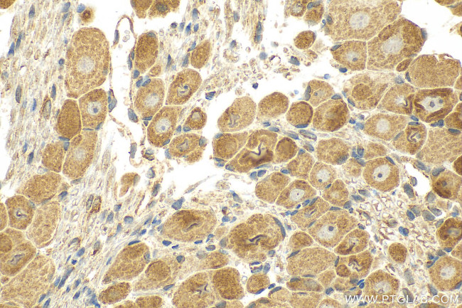 MRGPRX3 Antibody in Immunohistochemistry (Paraffin) (IHC (P))