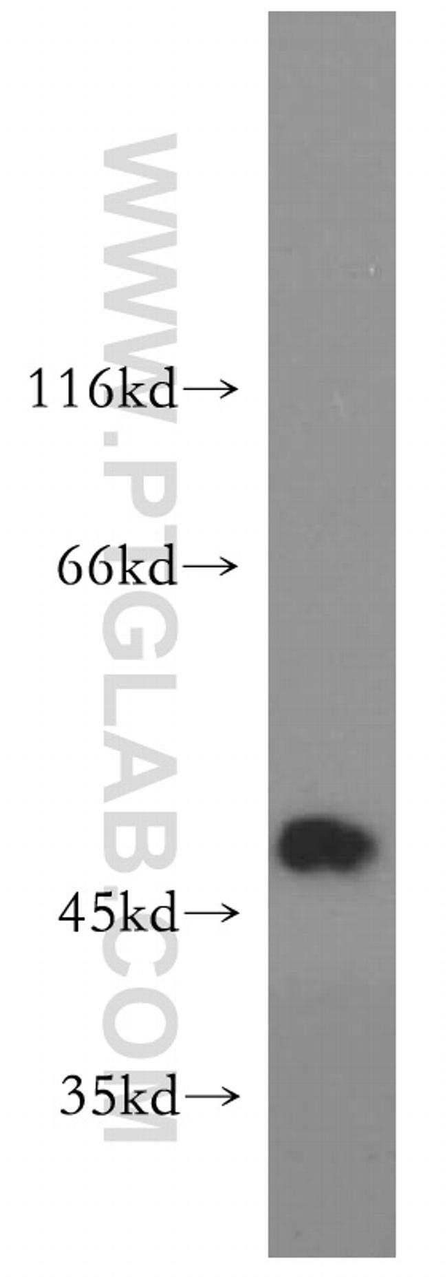 GLRA1 Antibody in Western Blot (WB)