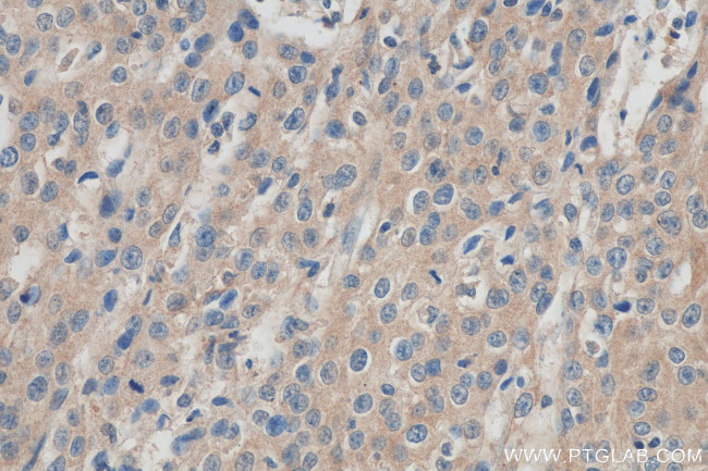 TMPRSS3 Antibody in Immunohistochemistry (Paraffin) (IHC (P))