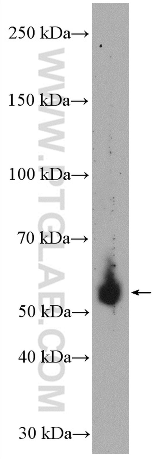 HFE Antibody in Western Blot (WB)