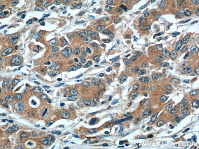 LOX Antibody in Immunohistochemistry (Paraffin) (IHC (P))