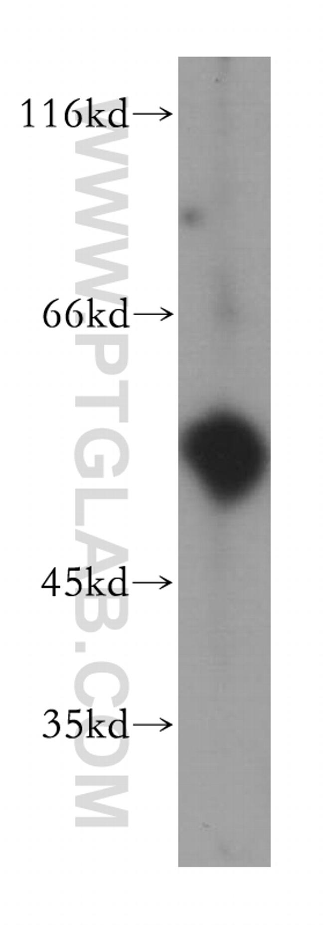 uPA Antibody in Western Blot (WB)