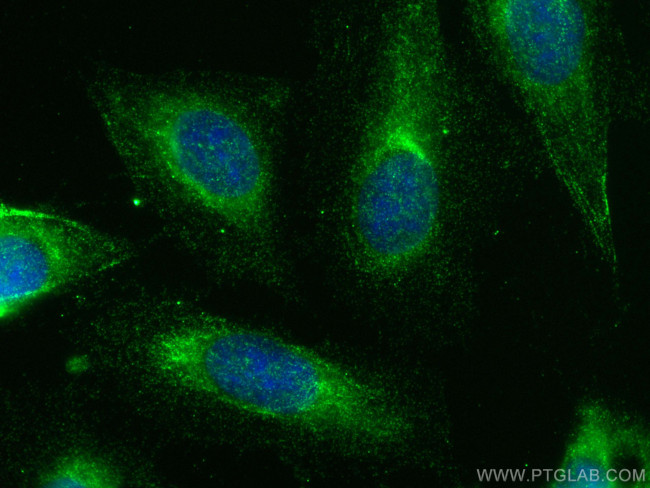 MYO1C Antibody in Immunocytochemistry (ICC/IF)
