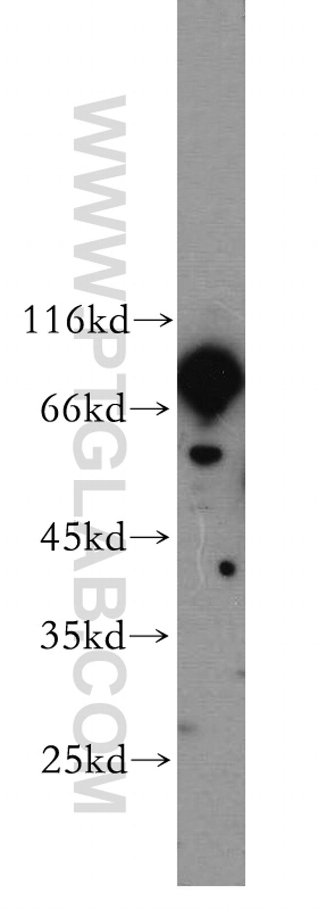 RGS9 Antibody in Western Blot (WB)