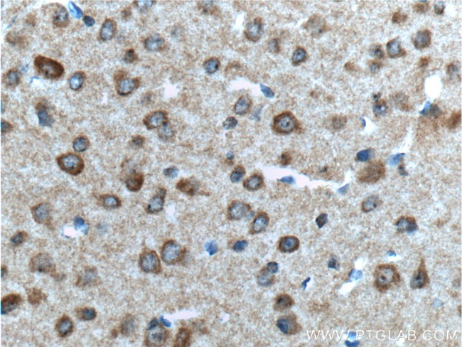 GPR75 Antibody in Immunohistochemistry (Paraffin) (IHC (P))