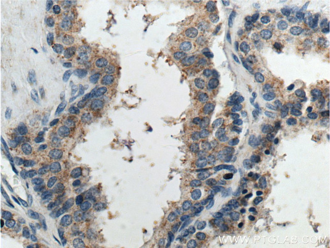 GPR21 Antibody in Immunohistochemistry (Paraffin) (IHC (P))