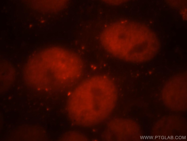 Cdc7 Kinase Antibody in Immunocytochemistry (ICC/IF)