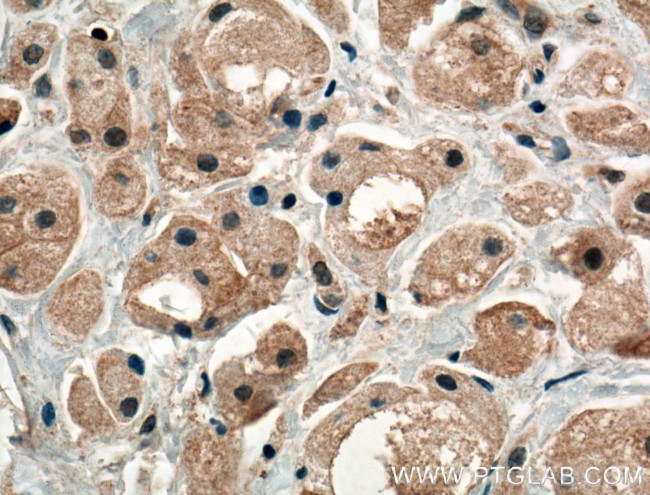 PRKAR1B Antibody in Immunohistochemistry (Paraffin) (IHC (P))