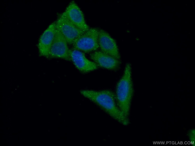 RBMX2 Antibody in Immunocytochemistry (ICC/IF)