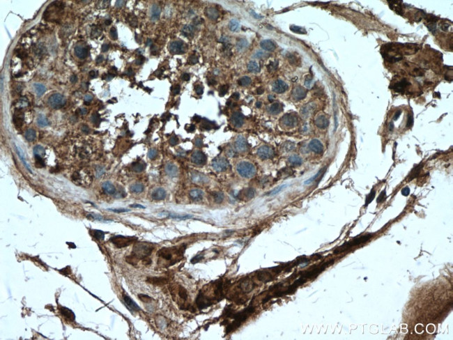 INSL3 Antibody in Immunohistochemistry (Paraffin) (IHC (P))