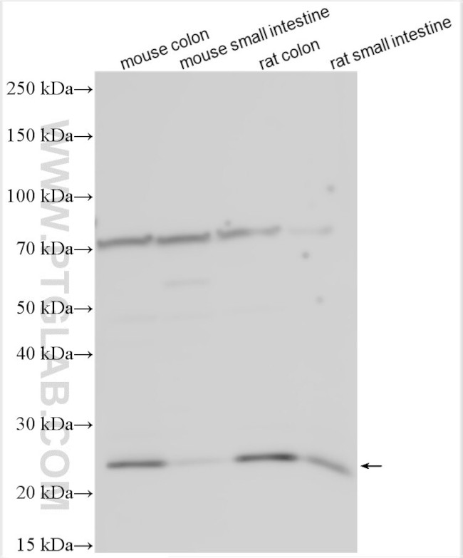 ADH1A Antibody in Western Blot (WB)