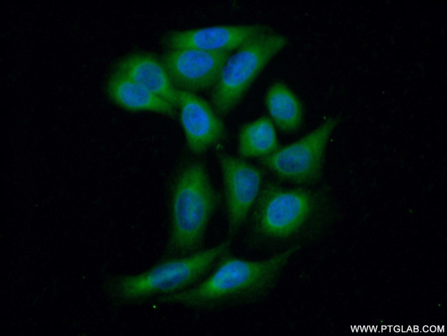 PP11 Antibody in Immunocytochemistry (ICC/IF)