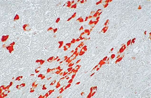 Hepatitis B Surface Antigen / HbsAg Antibody in Immunohistochemistry (IHC)
