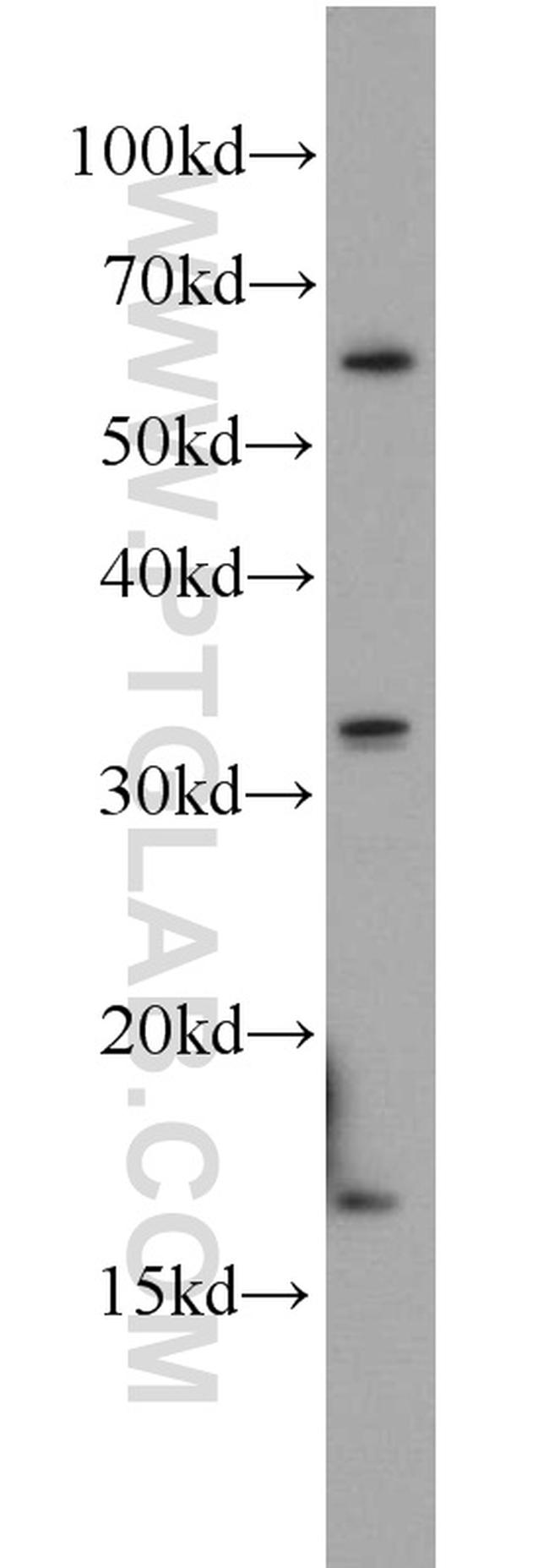 CREBL2 Antibody in Western Blot (WB)