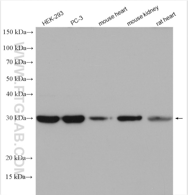 ATPAF1 Antibody in Western Blot (WB)