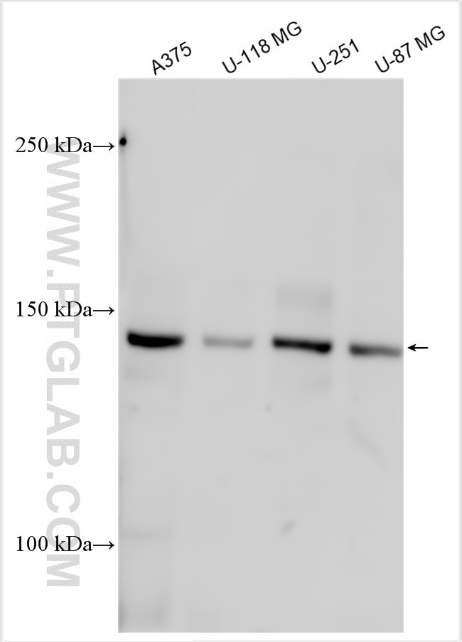 GREM1 Antibody in Western Blot (WB)