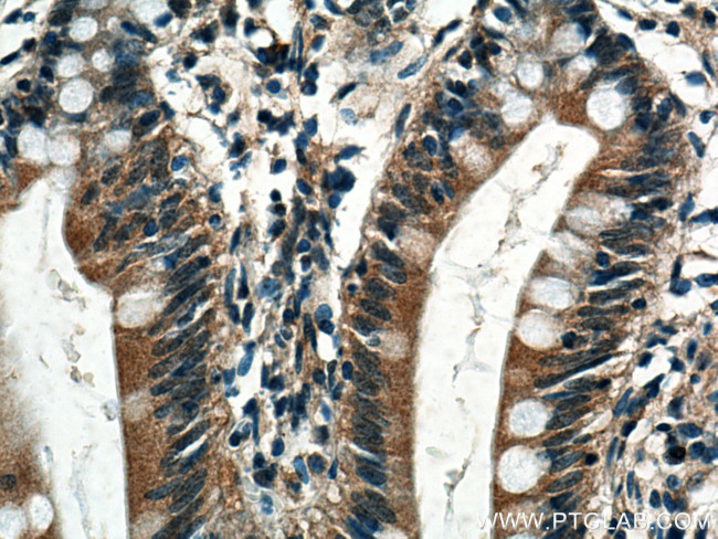 TRPM5 Antibody in Immunohistochemistry (Paraffin) (IHC (P))