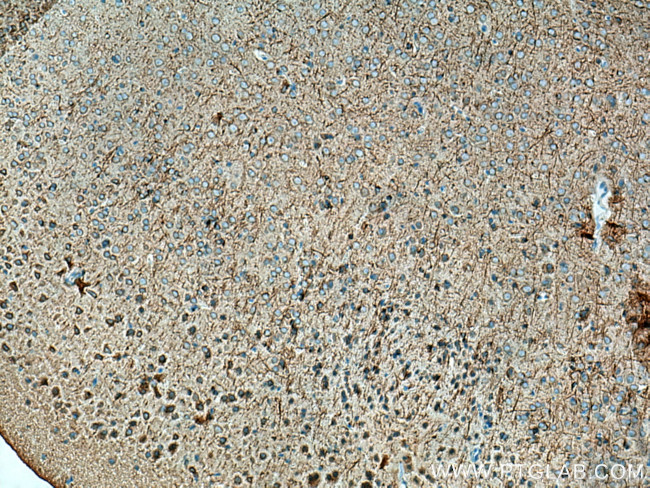 STYK1 Antibody in Immunohistochemistry (Paraffin) (IHC (P))