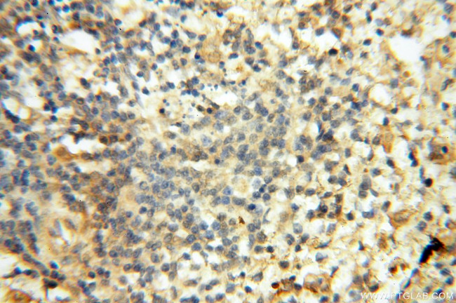 CARD6 Antibody in Immunohistochemistry (Paraffin) (IHC (P))