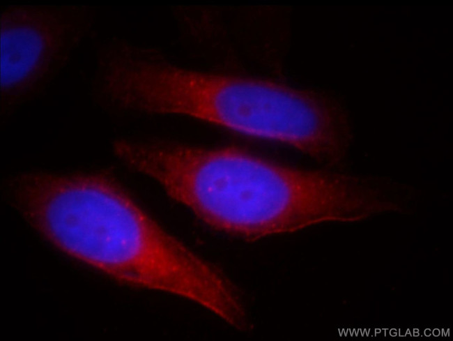 TNKS Antibody in Immunocytochemistry (ICC/IF)