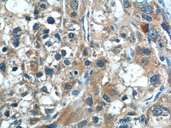 CGNL1 Antibody in Immunohistochemistry (Paraffin) (IHC (P))