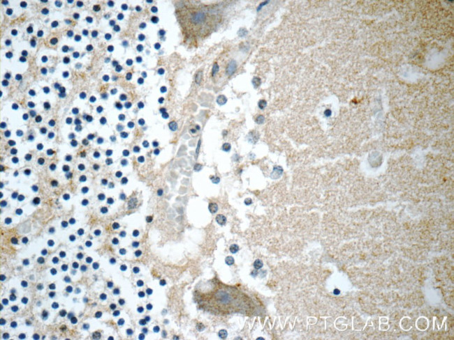 CHRNB3 Antibody in Immunohistochemistry (Paraffin) (IHC (P))