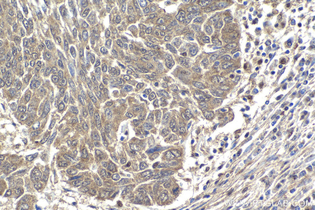 SMURF2 Antibody in Immunohistochemistry (Paraffin) (IHC (P))