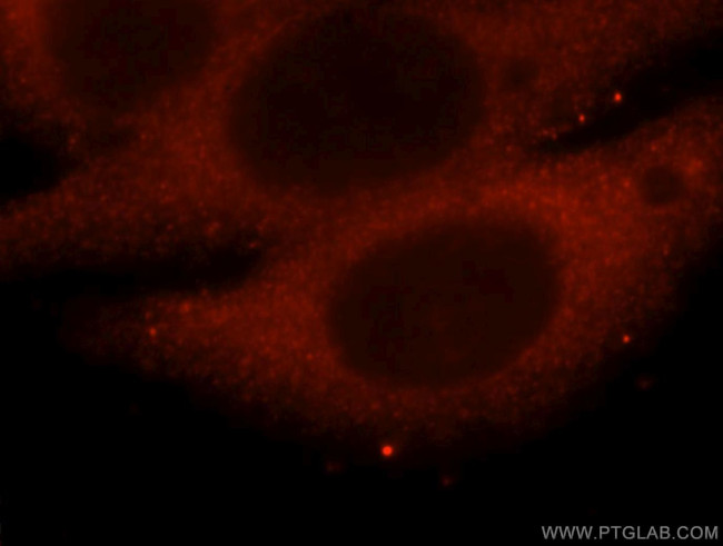 Securin / PTTG1 Antibody in Immunocytochemistry (ICC/IF)