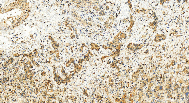 PGLYRP1 Antibody in Immunohistochemistry (Paraffin) (IHC (P))