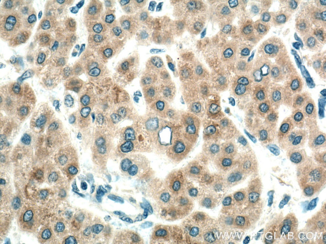 CYP7A1 Antibody in Immunohistochemistry (Paraffin) (IHC (P))