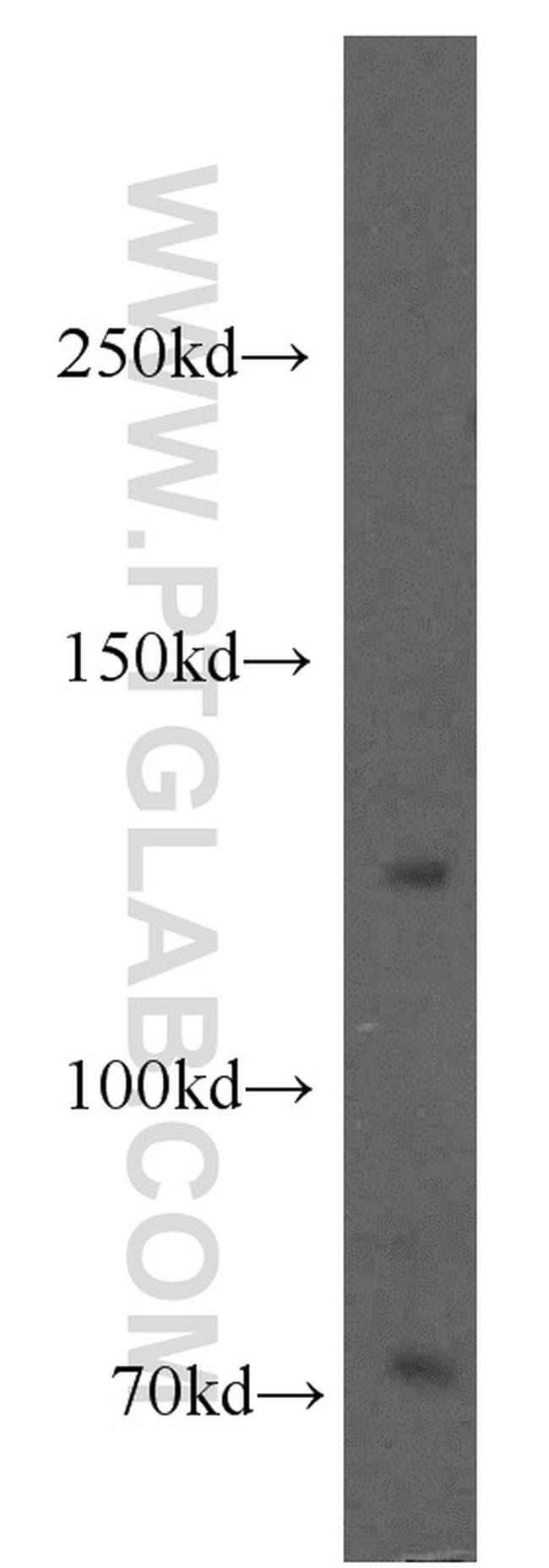 KIRREL3 Antibody in Western Blot (WB)