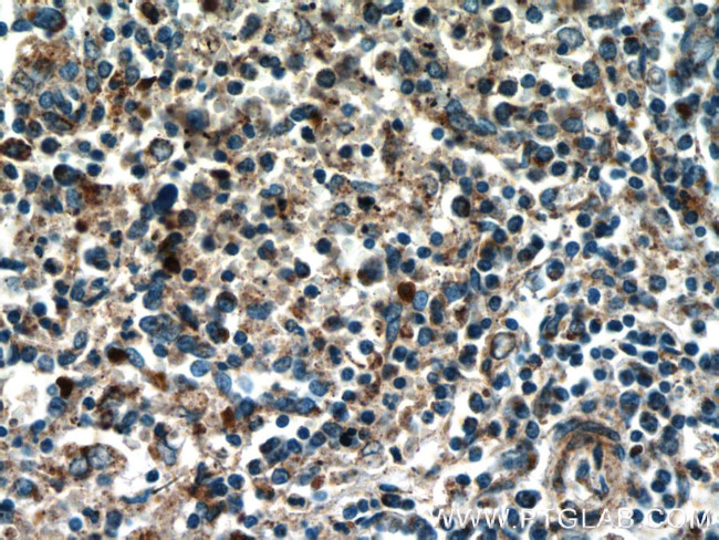 TREML4 Antibody in Immunohistochemistry (Paraffin) (IHC (P))