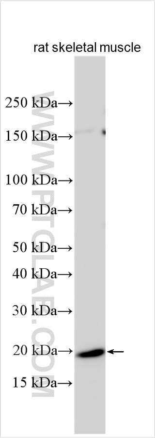 IGSF3 Antibody in Western Blot (WB)