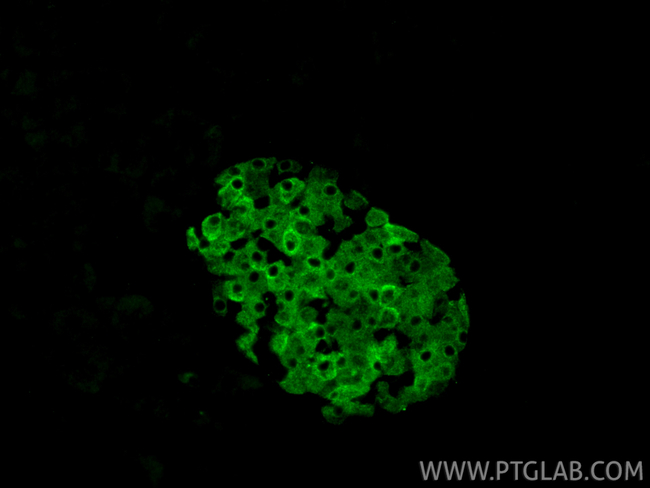G6PC2 Antibody in Immunohistochemistry (Paraffin) (IHC (P))