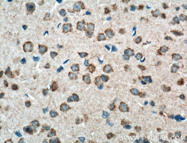 PCDHA9 Antibody in Immunohistochemistry (Paraffin) (IHC (P))