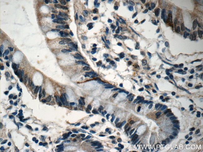 DNAH6 Antibody in Immunohistochemistry (Paraffin) (IHC (P))