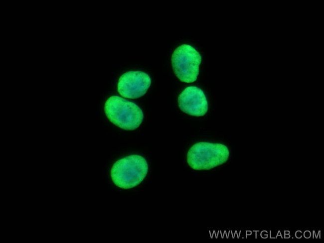 HIST1H1B Antibody in Immunocytochemistry (ICC/IF)
