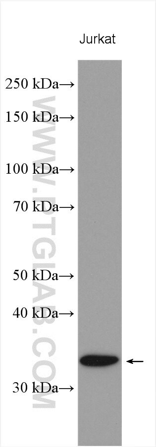 CENPP Antibody in Western Blot (WB)