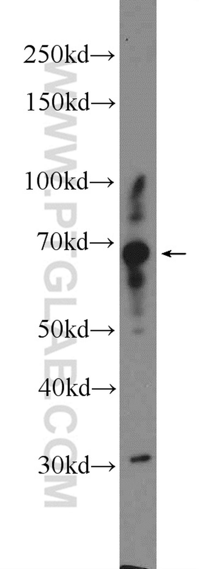 CPNE5 Antibody in Western Blot (WB)