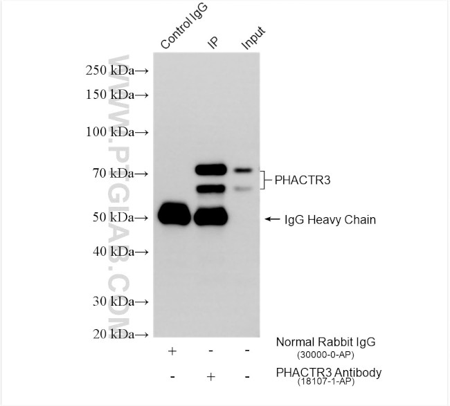 PHACTR3 Antibody in Immunoprecipitation (IP)