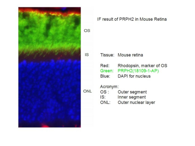 PRPH2 Antibody in Immunohistochemistry (IHC)