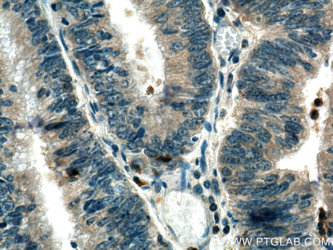 TRAF3IP3 Antibody in Immunohistochemistry (Paraffin) (IHC (P))