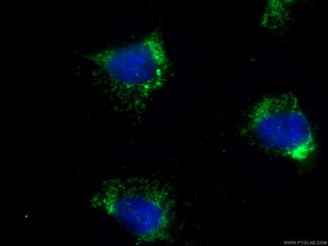 COX7A2 Antibody in Immunocytochemistry (ICC/IF)