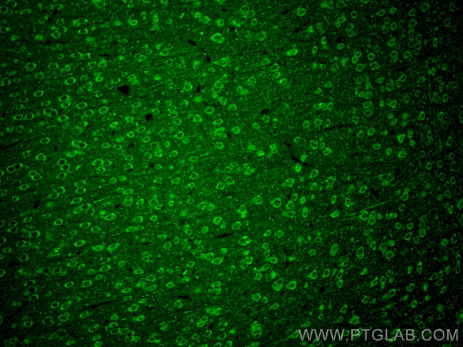 Synaptotagmin-5 Antibody in Immunohistochemistry (PFA fixed) (IHC (PFA))