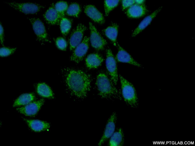 HRC Antibody in Immunocytochemistry (ICC/IF)