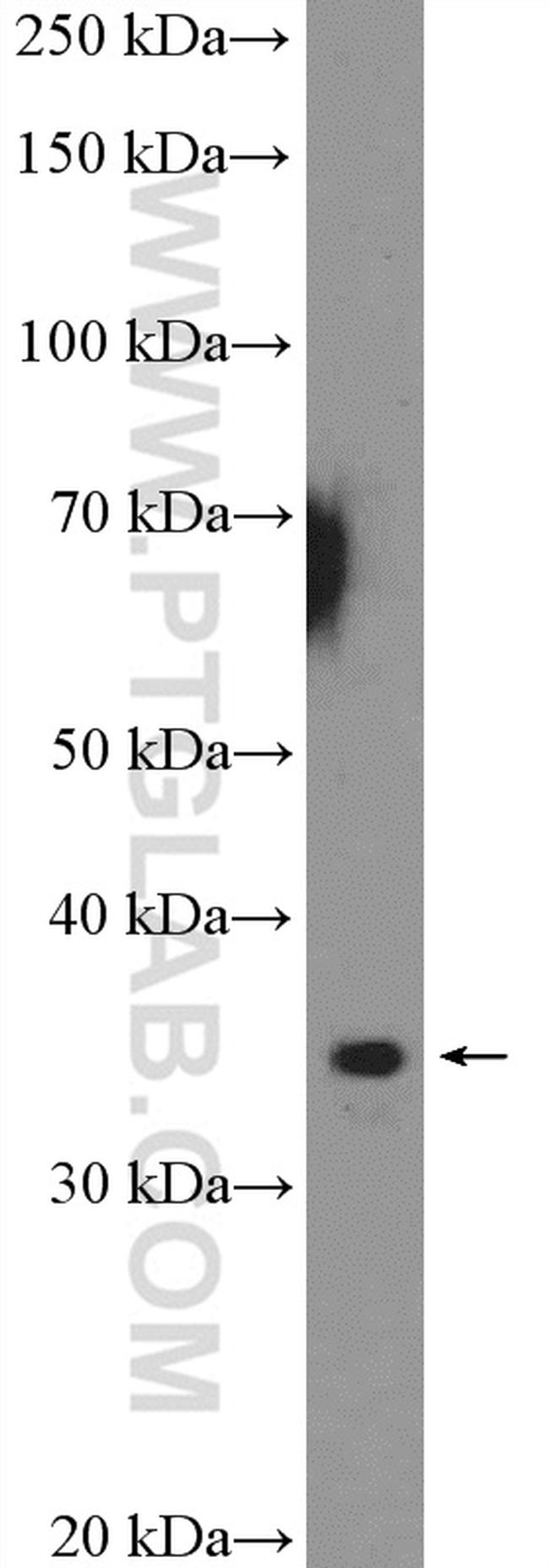 RPA4 Antibody in Western Blot (WB)