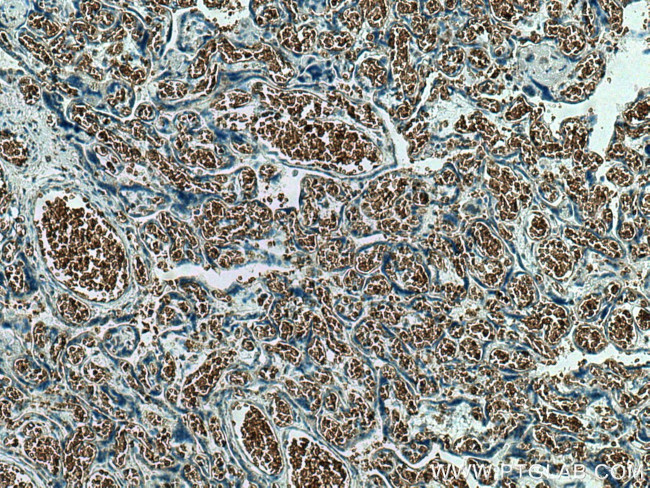 GYPC Antibody in Immunohistochemistry (Paraffin) (IHC (P))