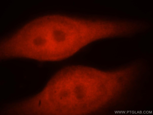 ZNF174 Antibody in Immunocytochemistry (ICC/IF)